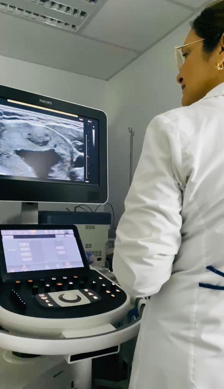 Nueva opción terapéutica en Formosa: Ablación percutánea con etanol para nódulos tiroideos quísticos