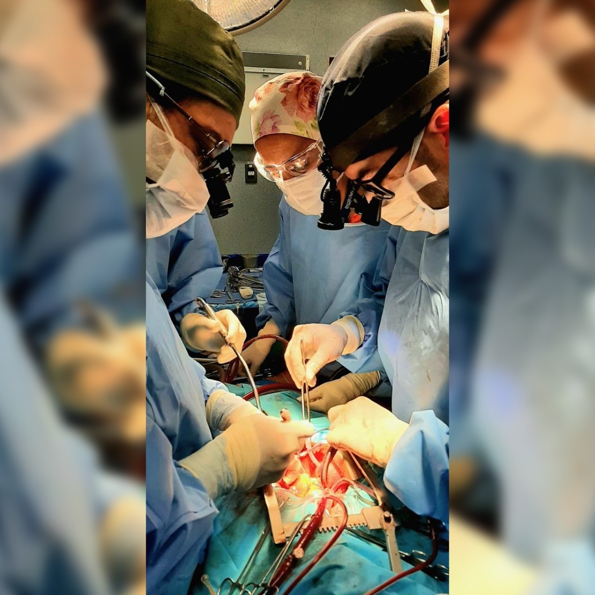 HAC reafirma su nivel de excelencia con exitosa cirugía de disección aórtica